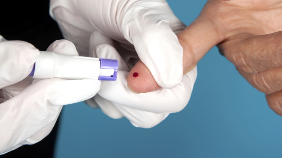 Realizarán testeos rápidos de VIH gratuitos en laboratorios públicos y privados